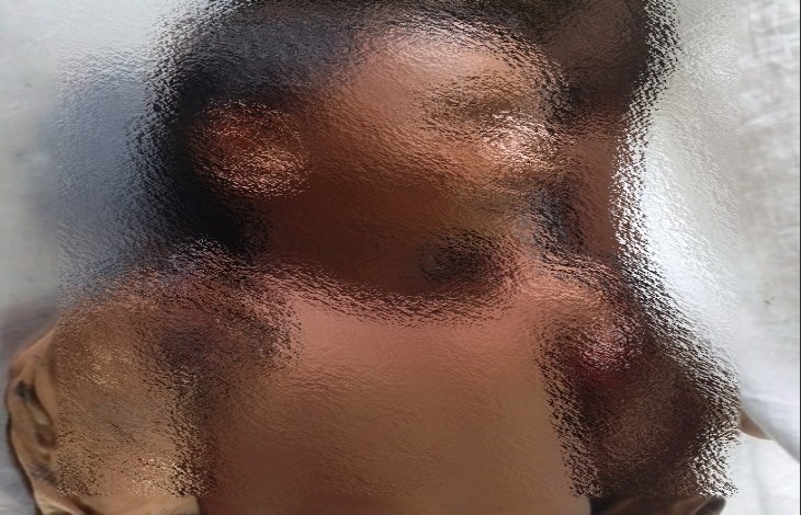 1000315691