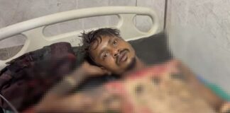 कोरबा के युवक को जिंदा जलाने की कोशिश,जांच जारी