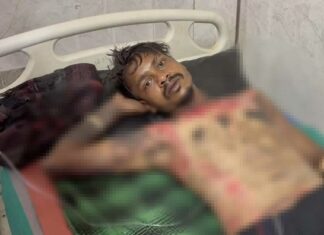 कोरबा के युवक को जिंदा जलाने की कोशिश,जांच जारी