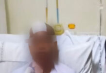 ब्रेन ट्यूमर का सफल ऑपरेशन, 7 घंटे की सर्जरी से महिला को मिला नया जीवन