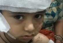 स्कूल के पहले दिन 4 साल के मासूम पर कुत्तों का हमला, सिर की चमड़ी नोची; चीख भी नहीं सुन पाया स्टाफ