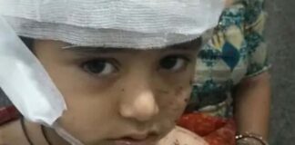 स्कूल के पहले दिन 4 साल के मासूम पर कुत्तों का हमला, सिर की चमड़ी नोची; चीख भी नहीं सुन पाया स्टाफ