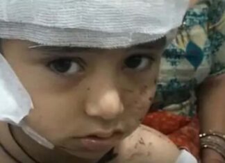 स्कूल के पहले दिन 4 साल के मासूम पर कुत्तों का हमला, सिर की चमड़ी नोची; चीख भी नहीं सुन पाया स्टाफ